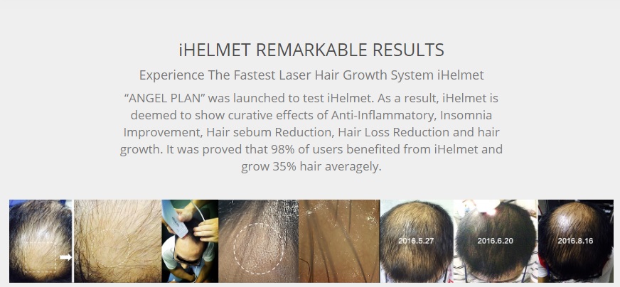 iHelmet Hair Growth Results